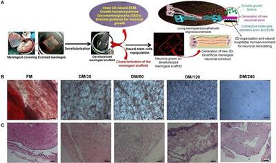 Bioengineering Human Neurological Constructs Using Decellularized Meningeal Scaffolds for Application in Spinal Cord Injury